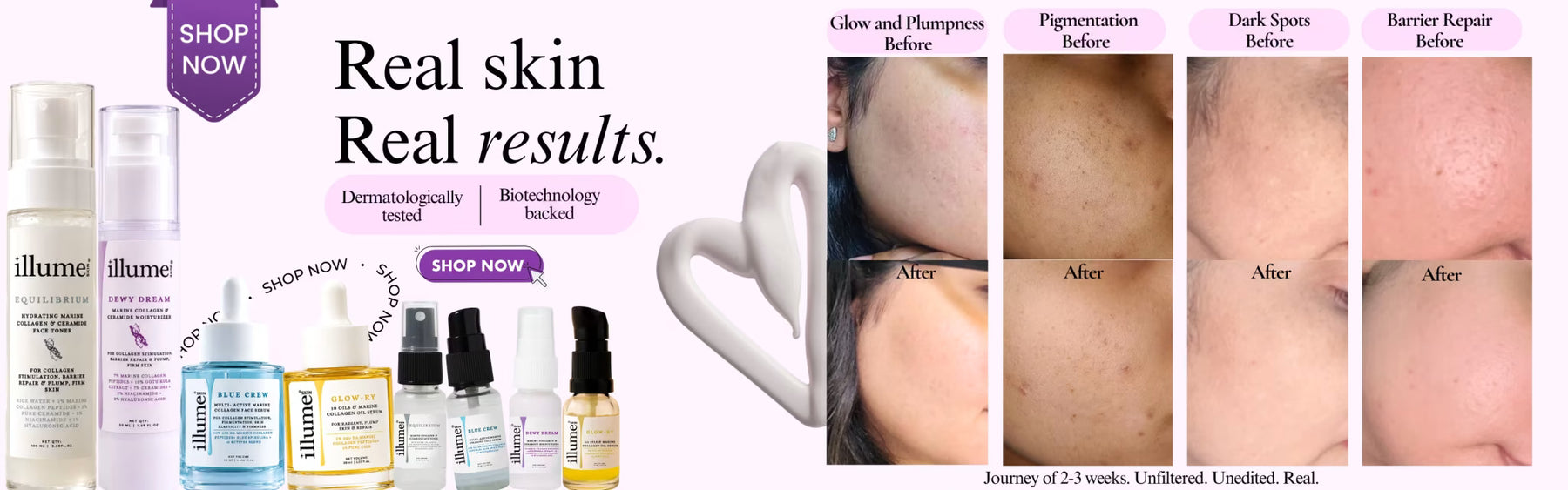 Real skin real results - ILLUME SKIN dermatologically tested collagen skincare