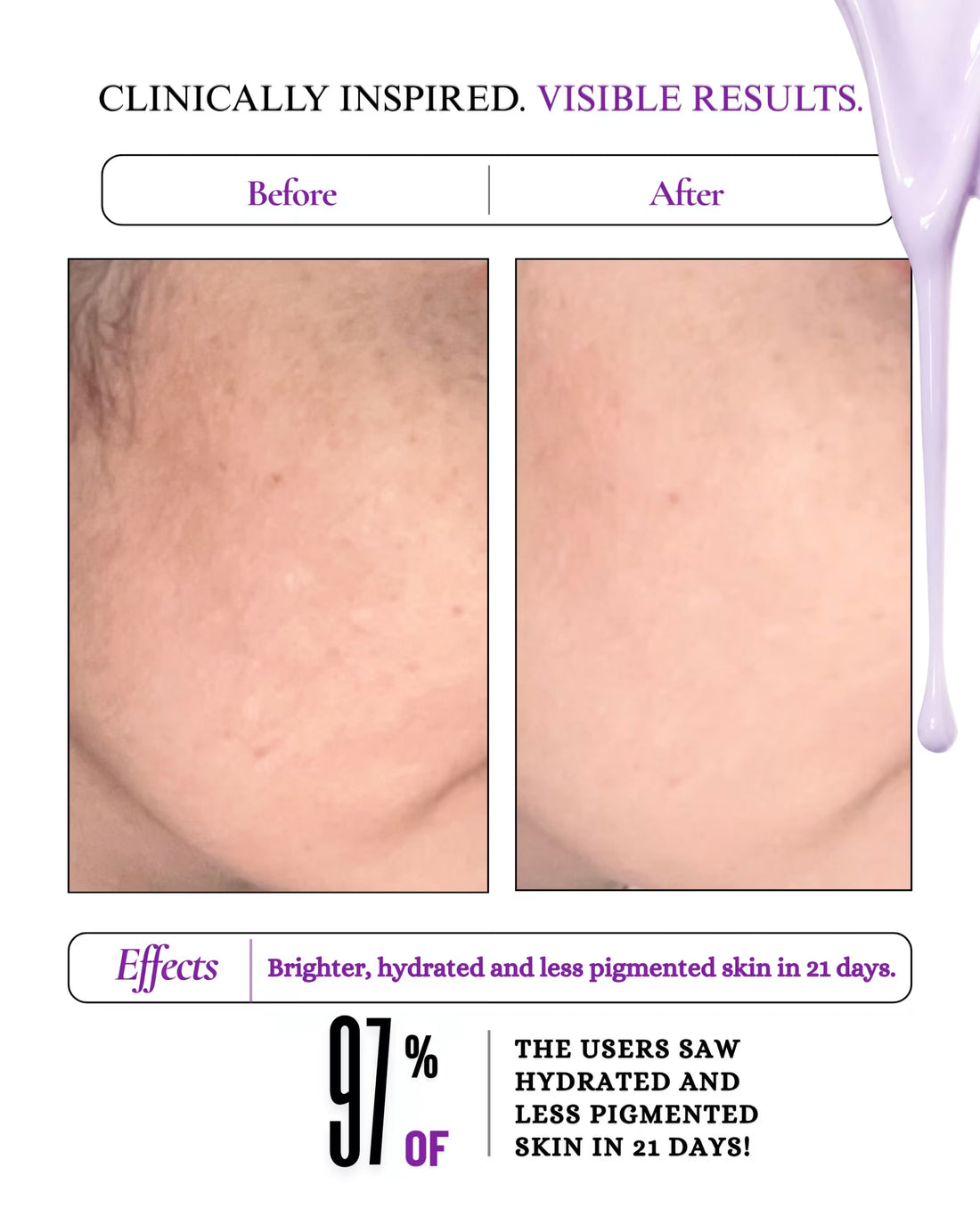 Dewy Dream 7% Collagen & Ceramide Face Moisturiser 50 ml - view 4
